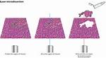 For Laser Capture Microdissection?