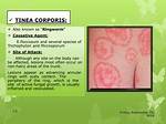 For Ringworm Causative Agent Is?