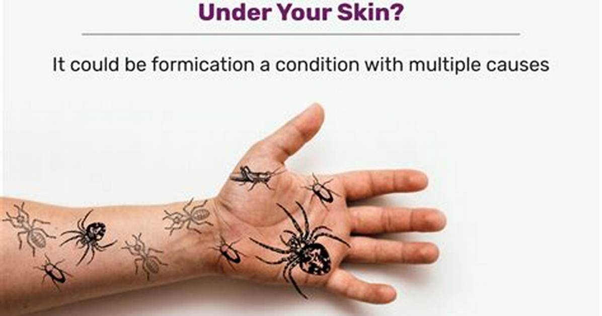 Formication Causes