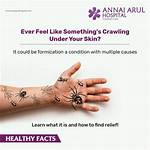 Formication Causes