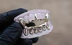 Gap Grillz