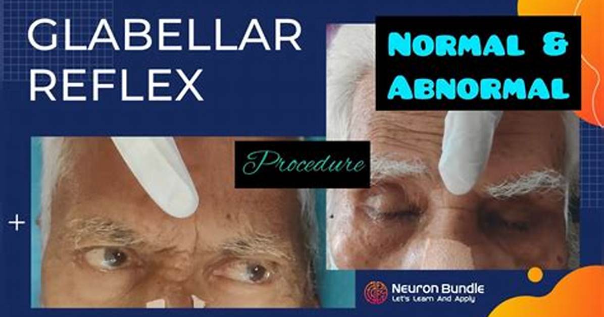 Glabellar Reflex