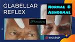 Glabellar Reflex