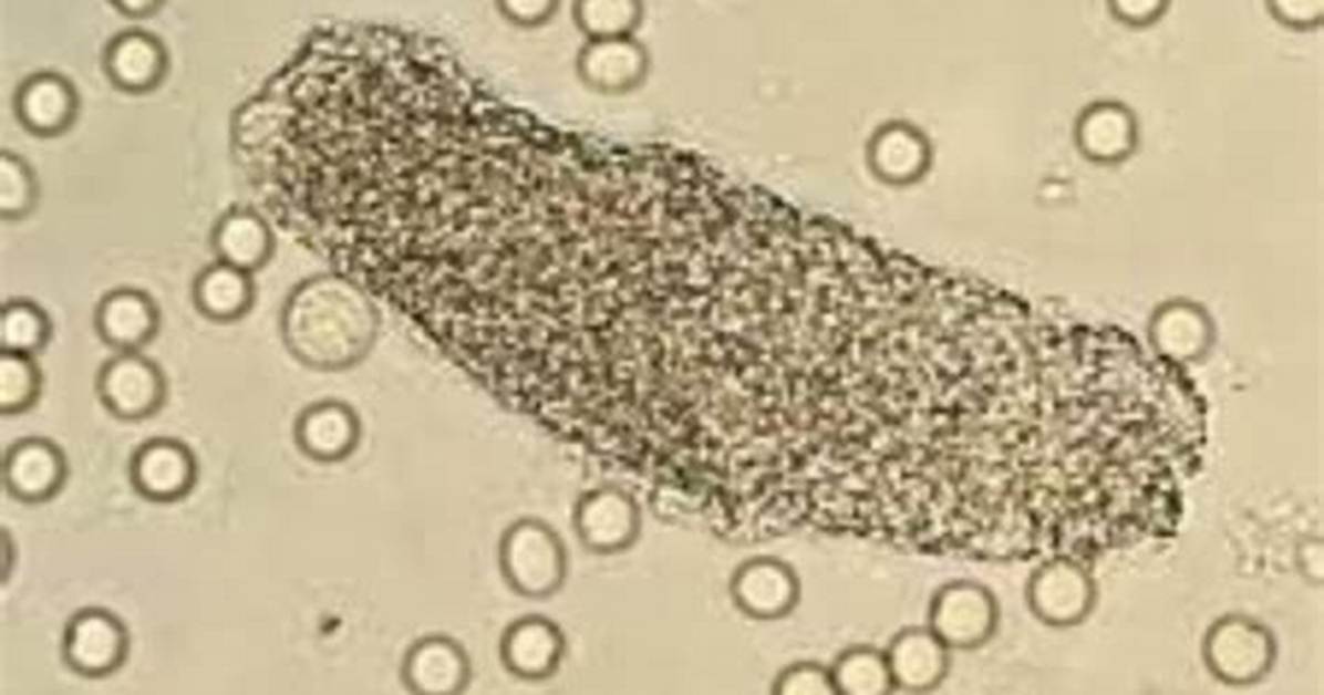 Granular Cast