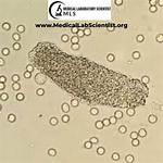 Granular Cast