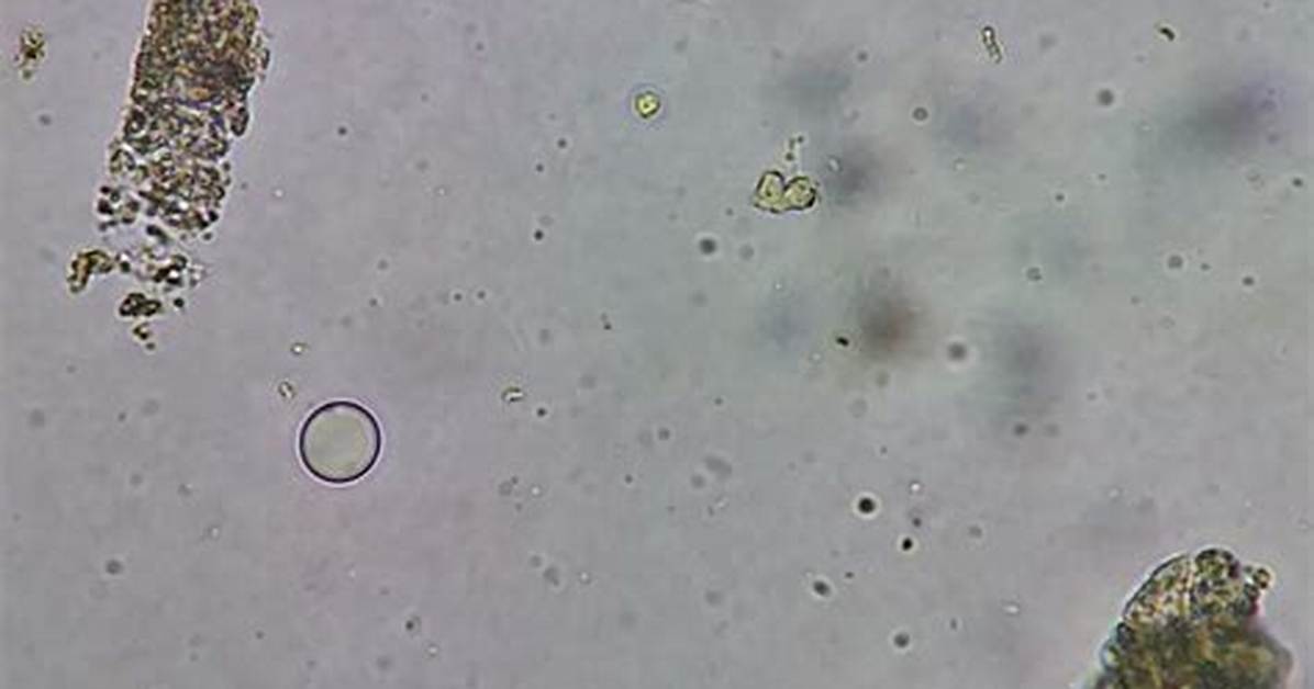 Granular Casts