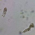 Granular Casts