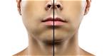 Has a Swollen Cheeks?