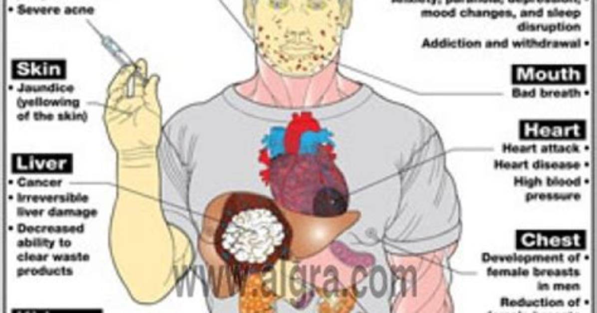 Has Steroids Side Effects?