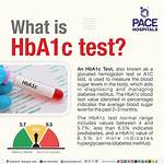 Has Test Full Form?