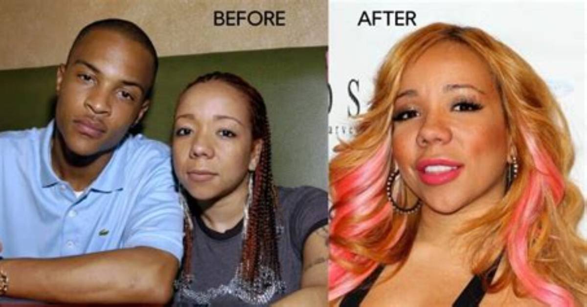 Has Tiny Had Surgery?