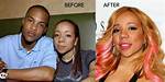Has Tiny Had Surgery?
