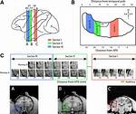 Hierarchical Auditory Processing Directed Rostrally Along the Monkey’s Supratemporal Plane - ePrints