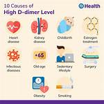 High D Dimer Causes