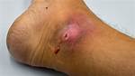 Horribly Wounds