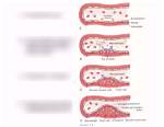 How Atherosclerosis Develops Quizlet?