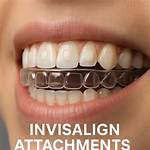 How Attachments Work Invisalign?