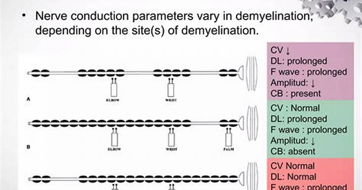 How Demyelination Affect Conduction?