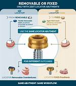 How Do Abutment Clips Work