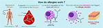 How Do Allergies Work?