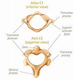 How Do C1 and C2 Differ from Other Vertebrae