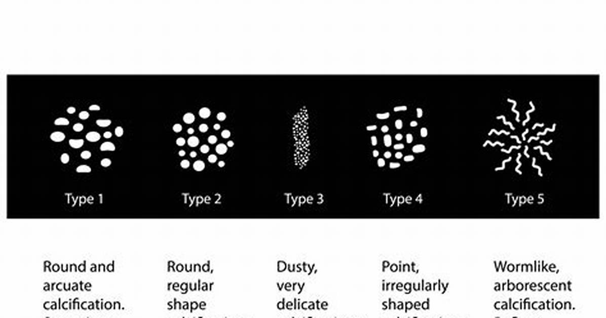 How Do Calcifications Form?