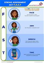 How Do Doctors Test for Stroke?