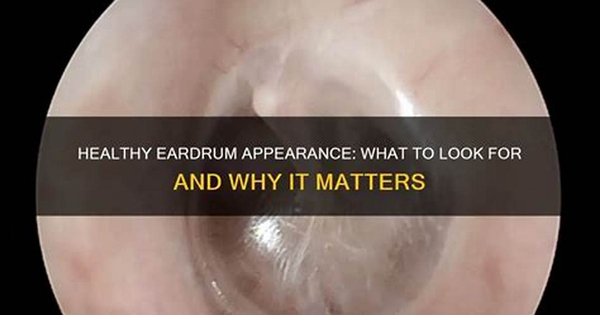 How Do Eardrums Look Like?