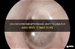 How Do Eardrums Look Like?