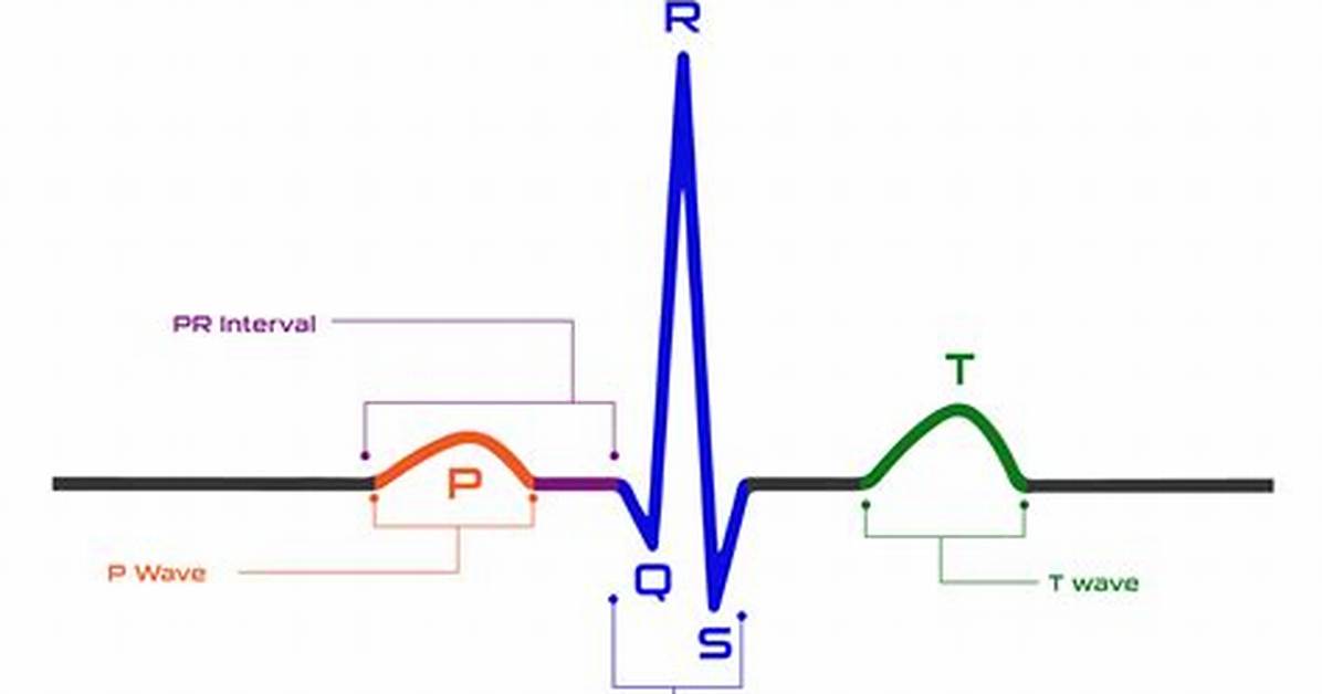 How Do Electrocardiograms Work?