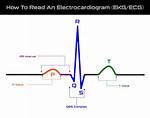How Do Electrocardiograms Work?