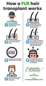 How Do Hair Implants Work