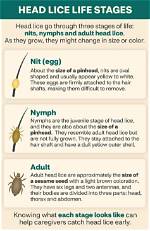 How Do Head Lice Start?
