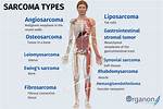 How Do Sarcomas Form?