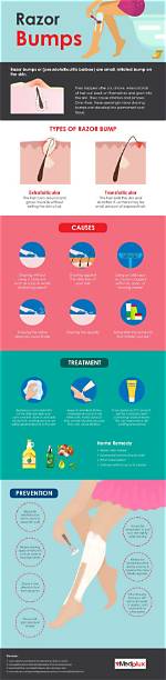 How Do You Avoid Razor Bumps?