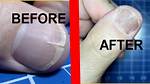 How Do You Fix a Split Horizontal Nail? Check This out | Horizontal Nail Split