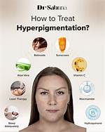 How Do You Fix Hyperpigmentation?