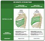 How Do You Fix Rib Dysfunction