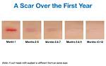 How Do You Get Scars
