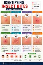 How Do You Identify a Bite