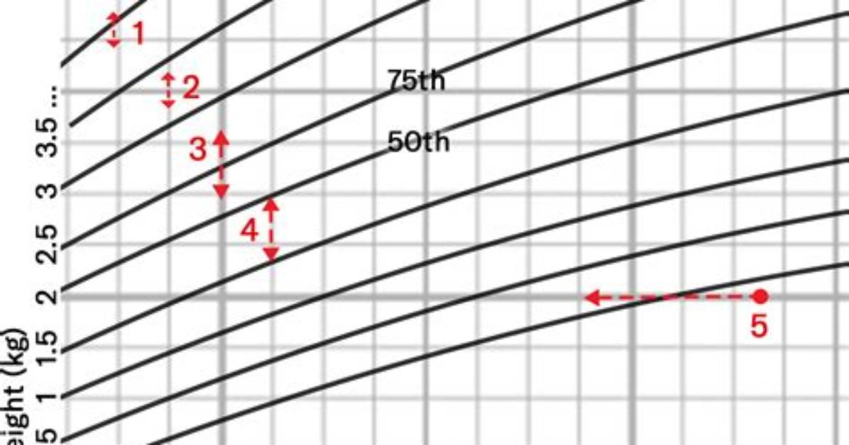 How Do You Plot a Growth Chart