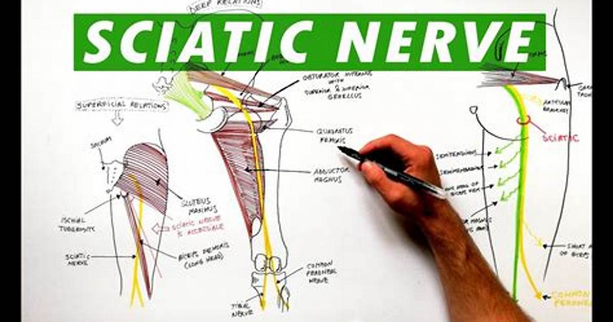 How Do You Spell Sciatic Nerve