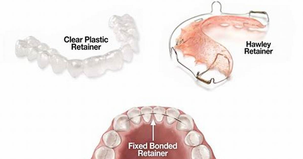 How Do You Store Retainers?