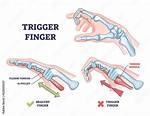 How Does a Finger Work