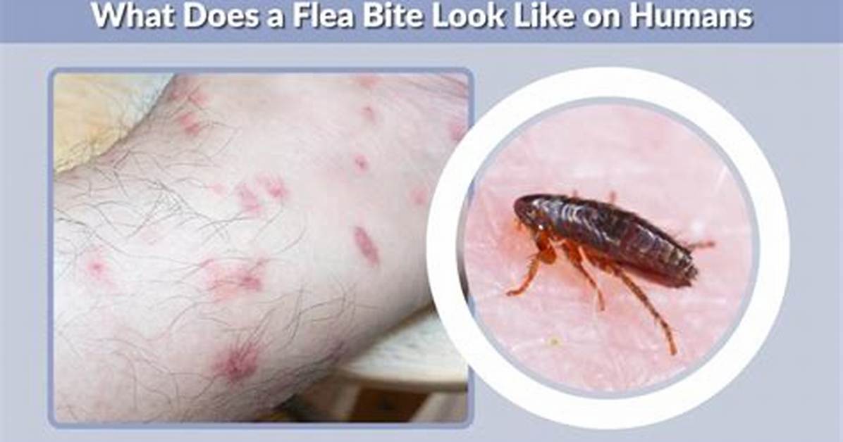 How Does a Flea Bite?