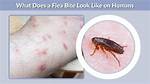 How Does a Flea Bite?