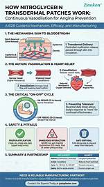 How Does a Nitroglycerin Patch Work