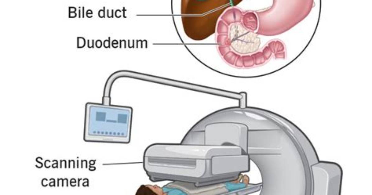 How Does a Pipida Scan Work?