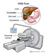 How Does a Pipida Scan Work?