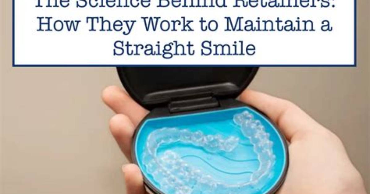 How Does a Retainer Work?